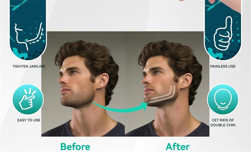 Kit com 6 Treinadores de Mandíbula em Silicone – Exercitador Facial para Músculos do Rosto, Pescoço, Queixo e Bochechas + Caixa Organizadora
