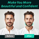 Kit com 6 Treinadores de Mandíbula em Silicone – Exercitador Facial para Músculos do Rosto, Pescoço, Queixo e Bochechas + Caixa Organizadora